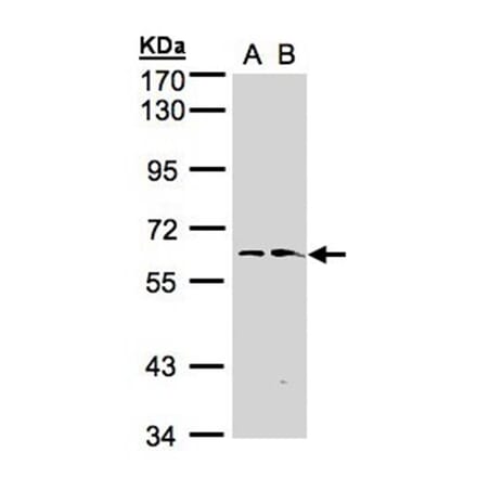 flavin containing monooxygenase 1 antibody from Signalway Antibody (22997) - Antibodies.com