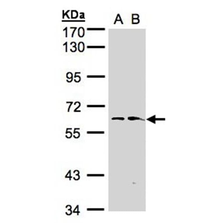 flavin containing monooxygenase 1 antibody from Signalway Antibody (22997) - Antibodies.com