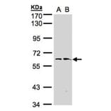 flavin containing monooxygenase 1 antibody from Signalway Antibody (22997) - Antibodies.com