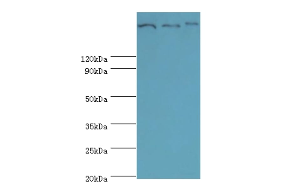 Clathrin heavy chain 2 Polyclonal Antibody from Signalway Antibody (42127) - Antibodies.com