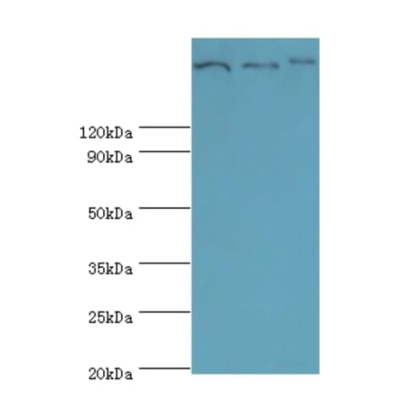 Clathrin heavy chain 2 Polyclonal Antibody from Signalway Antibody (42127) - Antibodies.com
