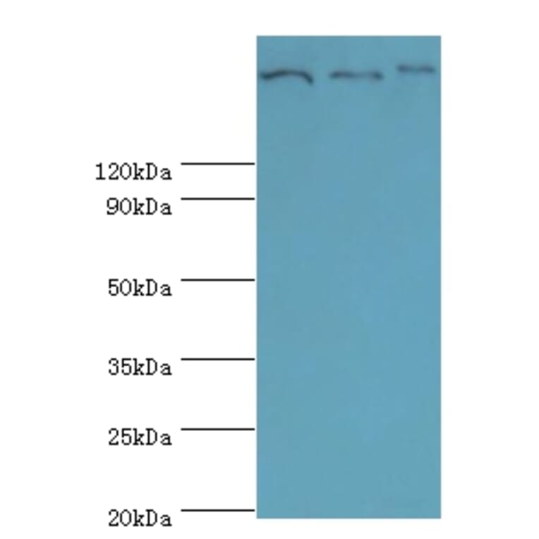 Clathrin heavy chain 2 Polyclonal Antibody from Signalway Antibody (42127) - Antibodies.com