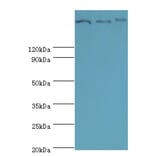 Clathrin heavy chain 2 Polyclonal Antibody from Signalway Antibody (42127) - Antibodies.com