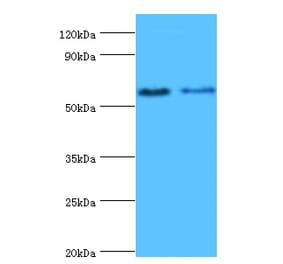 Estrogen receptor beta Polyclonal Antibody from Signalway Antibody (42161) - Antibodies.com