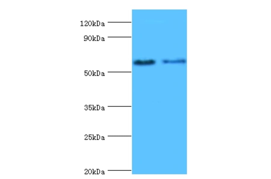 Estrogen receptor beta Polyclonal Antibody from Signalway Antibody (42161) - Antibodies.com