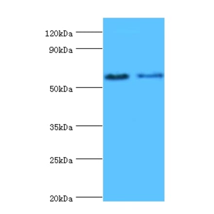 Estrogen receptor beta Polyclonal Antibody from Signalway Antibody (42161) - Antibodies.com