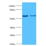 Estrogen receptor beta Polyclonal Antibody from Signalway Antibody (42161) - Antibodies.com
