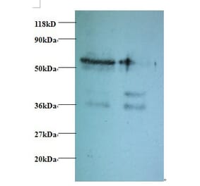 Tax1-binding protein 3 Polyclonal Antibody from Signalway Antibody (42414) - Antibodies.com