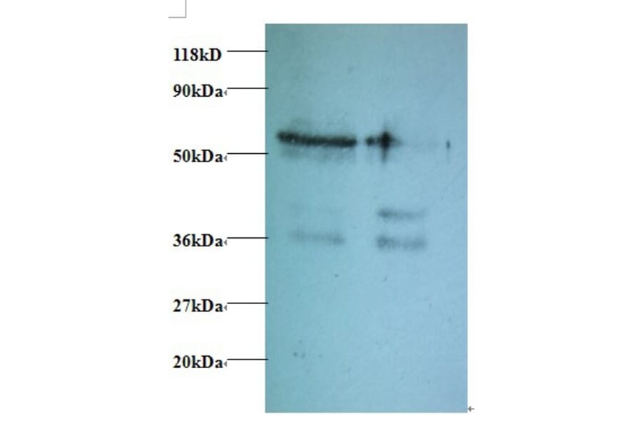 Tax1-binding protein 3 Polyclonal Antibody from Signalway Antibody (42414) - Antibodies.com