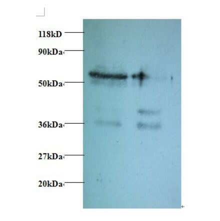 Tax1-binding protein 3 Polyclonal Antibody from Signalway Antibody (42414) - Antibodies.com