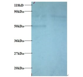 C-C motif chemokine 22 Polyclonal Antibody from Signalway Antibody (42443) - Antibodies.com