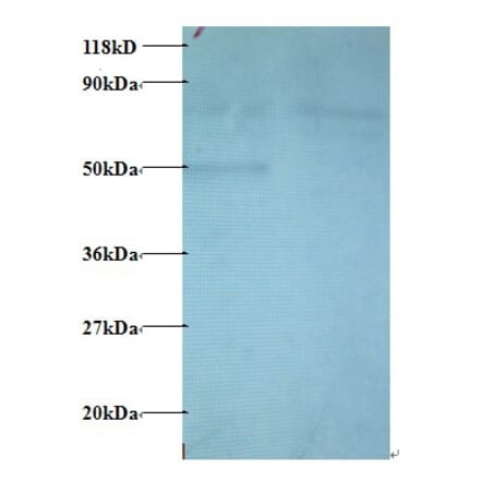C-C motif chemokine 22 Polyclonal Antibody from Signalway Antibody (42443) - Antibodies.com