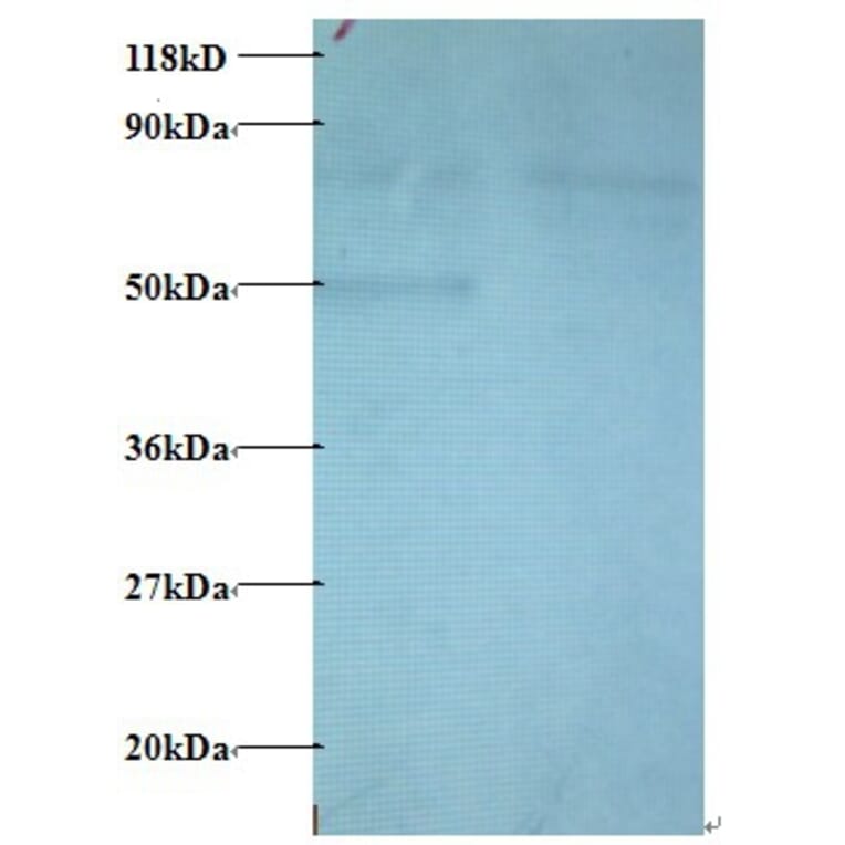 C-C motif chemokine 22 Polyclonal Antibody from Signalway Antibody (42443) - Antibodies.com