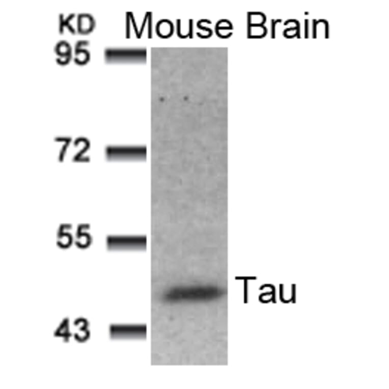 Western blot - Tau (Ab-181) Antibody from Signalway Antibody (21096) - Antibodies.com