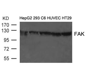 Western blot - FAK (Ab-397) Antibody from Signalway Antibody (21208) - Antibodies.com