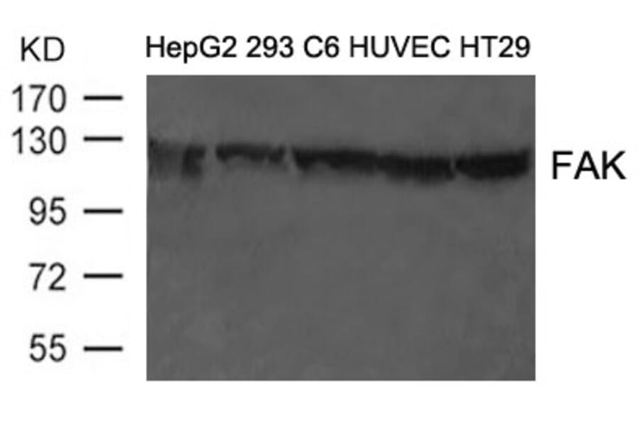 Western blot - FAK (Ab-397) Antibody from Signalway Antibody (21208) - Antibodies.com