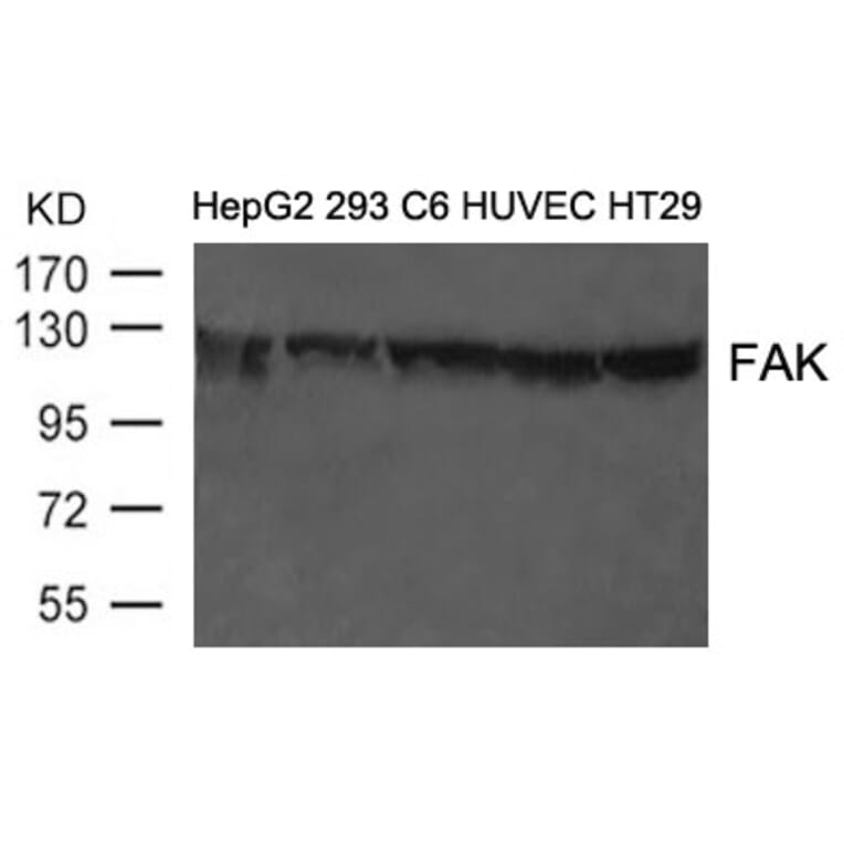 Western blot - FAK (Ab-397) Antibody from Signalway Antibody (21208) - Antibodies.com