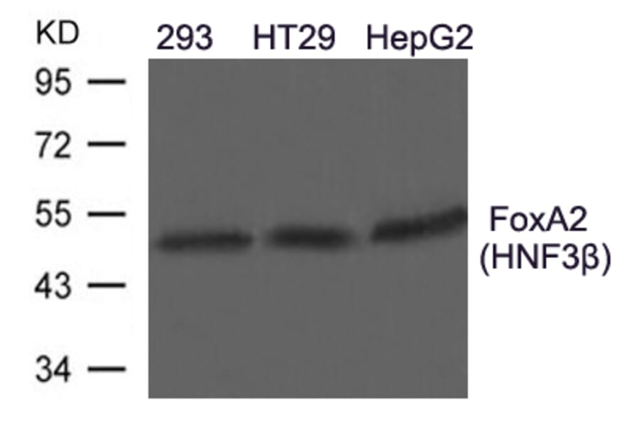 Western blot - FoxA2 (HNF3b) Antibody from Signalway Antibody (21607) - Antibodies.com