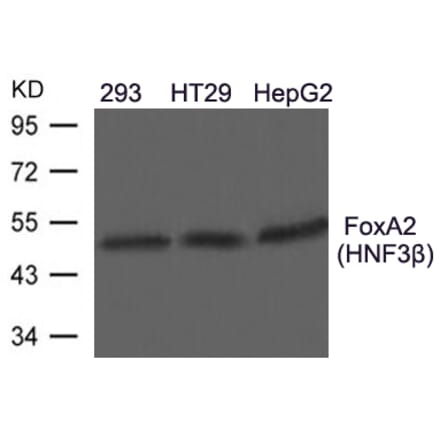 Western blot - FoxA2 (HNF3b) Antibody from Signalway Antibody (21607) - Antibodies.com