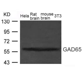 Western blot - GAD65 (GAD2) Antibody from Signalway Antibody (21611) - Antibodies.com