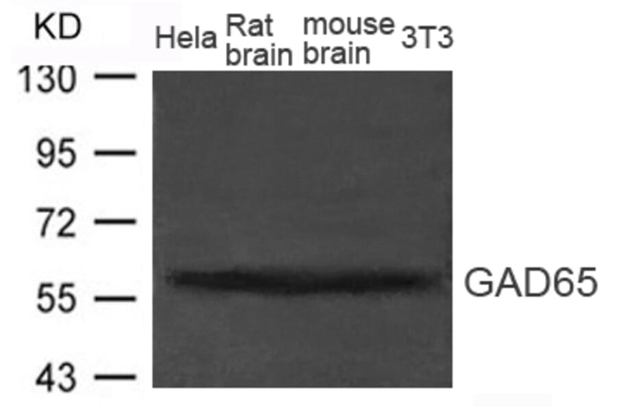 Western blot - GAD65 (GAD2) Antibody from Signalway Antibody (21611) - Antibodies.com