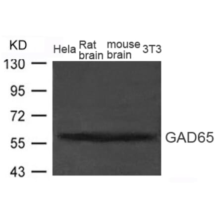 Western blot - GAD65 (GAD2) Antibody from Signalway Antibody (21611) - Antibodies.com