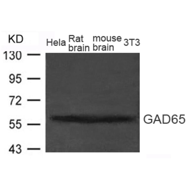 Western blot - GAD65 (GAD2) Antibody from Signalway Antibody (21611) - Antibodies.com