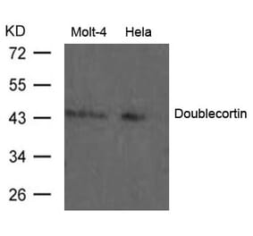 Western blot - Doublecortin Antibody from Signalway Antibody (21630) - Antibodies.com