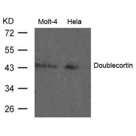 Western blot - Doublecortin Antibody from Signalway Antibody (21630) - Antibodies.com