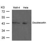 Western blot - Doublecortin Antibody from Signalway Antibody (21630) - Antibodies.com