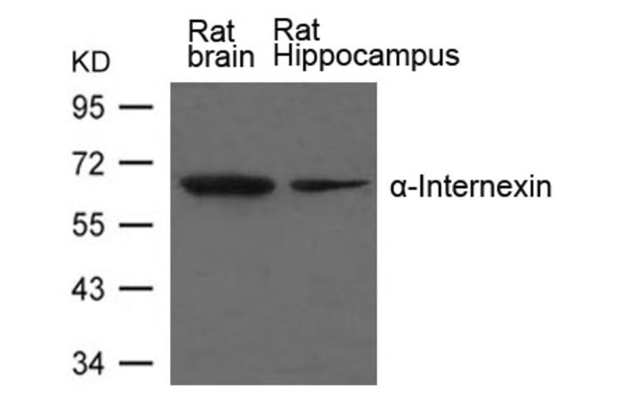 Western blot - a-Internexin Antibody from Signalway Antibody (21638) - Antibodies.com