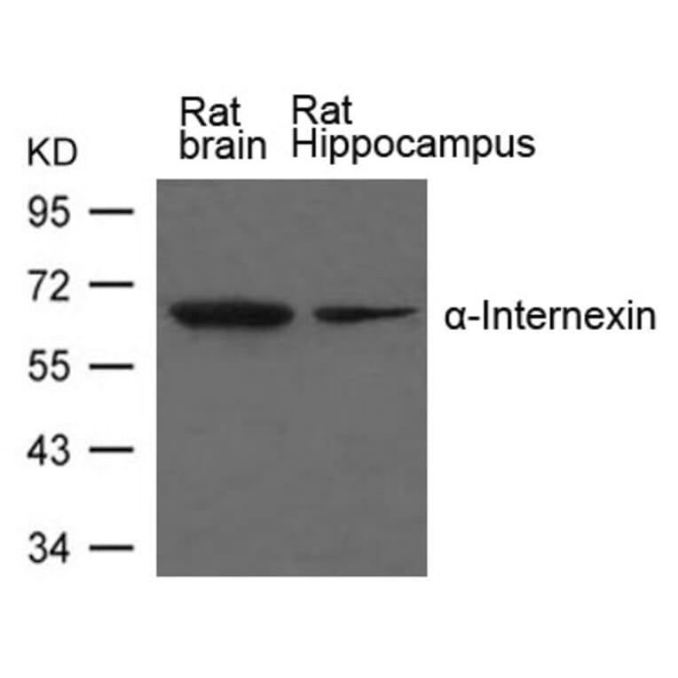 Western blot - a-Internexin Antibody from Signalway Antibody (21638) - Antibodies.com