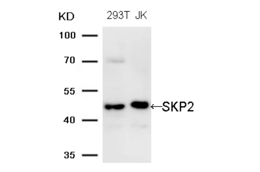 Western blot - SKP2 (Ab-64) Antibody from Signalway Antibody (21700) - Antibodies.com