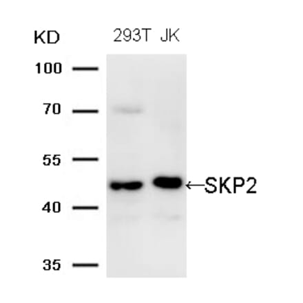 Western blot - SKP2 (Ab-64) Antibody from Signalway Antibody (21700) - Antibodies.com