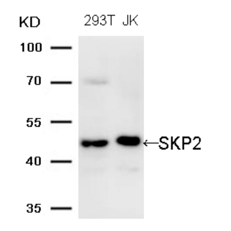 Western blot - SKP2 (Ab-64) Antibody from Signalway Antibody (21700) - Antibodies.com