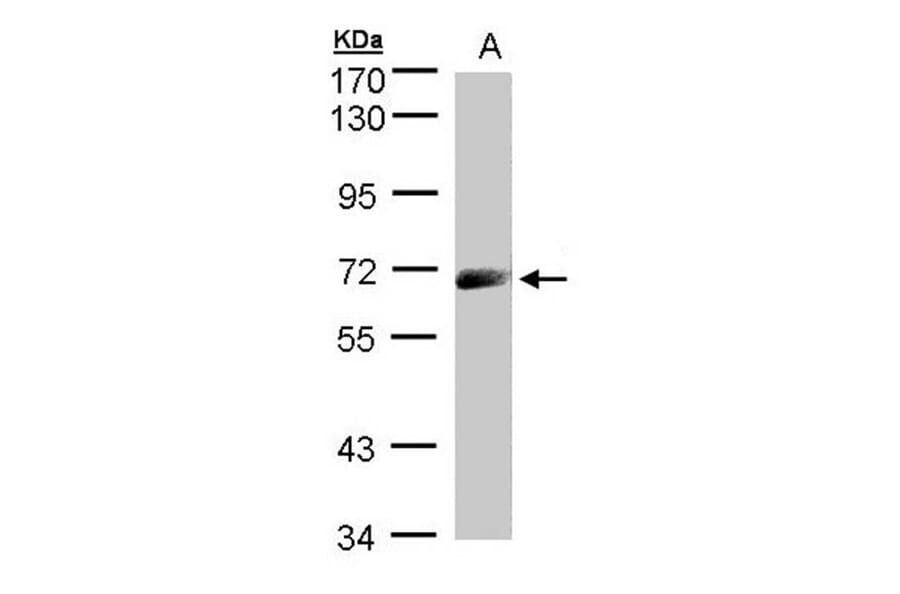 IL-12Rbeta1 antibody from Signalway Antibody (22503) - Antibodies.com