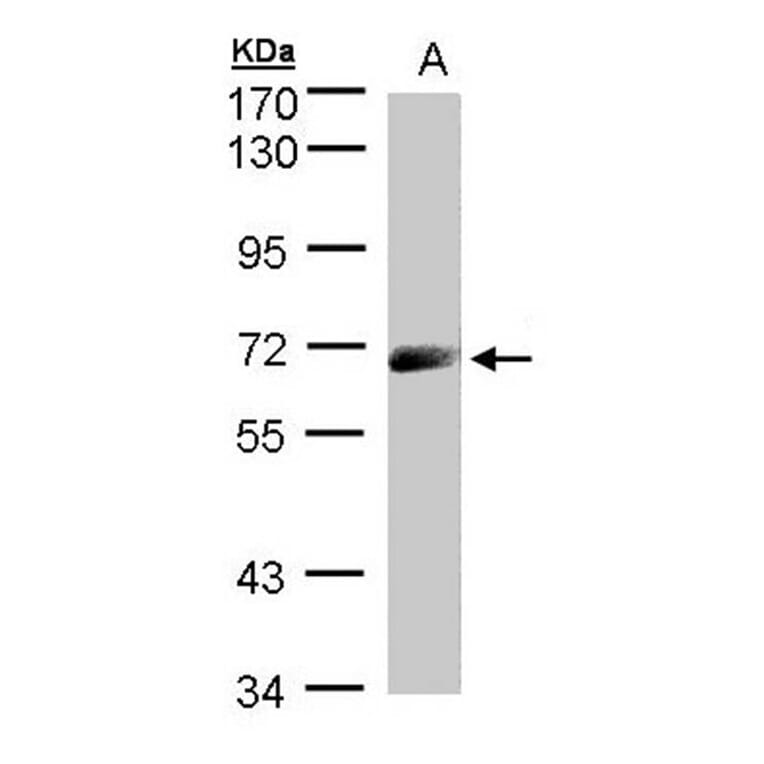 IL-12Rbeta1 antibody from Signalway Antibody (22503) - Antibodies.com