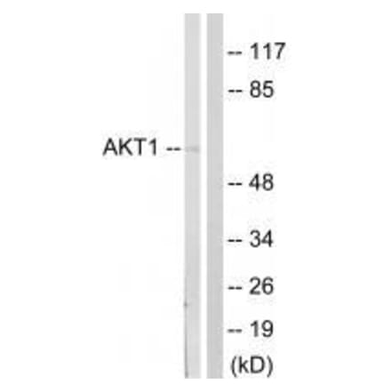 Western blot - Akt (Ab-124) Antibody from Signalway Antibody (33129) - Antibodies.com