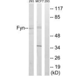 Western blot - Fyn (Ab-530) Antibody from Signalway Antibody (33131) - Antibodies.com