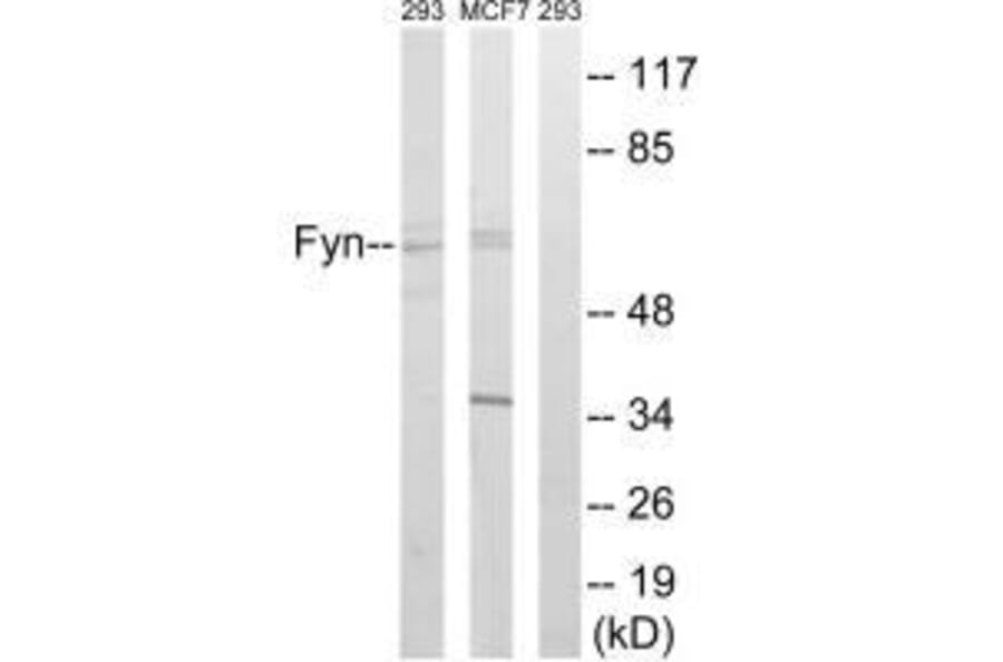 Western blot - Fyn (Ab-530) Antibody from Signalway Antibody (33131) - Antibodies.com