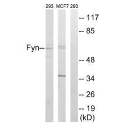 Western blot - Fyn (Ab-530) Antibody from Signalway Antibody (33131) - Antibodies.com