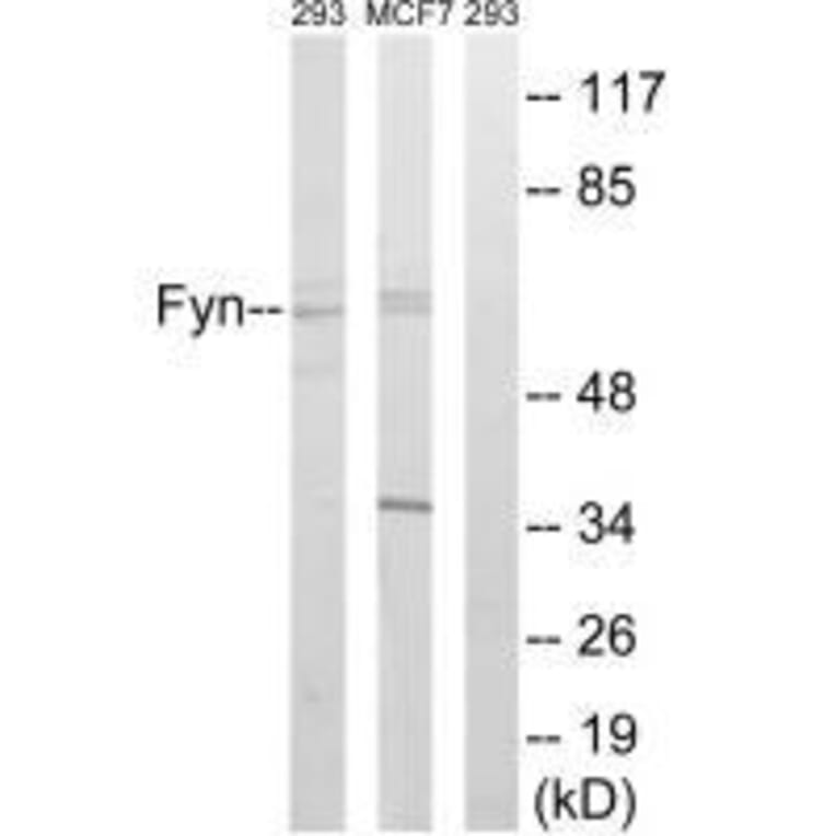 Western blot - Fyn (Ab-530) Antibody from Signalway Antibody (33131) - Antibodies.com