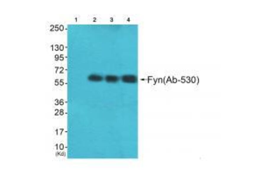 Western blot - Fyn (Ab-530) Antibody from Signalway Antibody (33131) - Antibodies.com