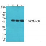 Western blot - Fyn (Ab-530) Antibody from Signalway Antibody (33131) - Antibodies.com