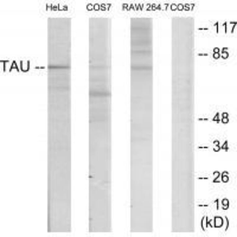 Western blot - Tau (Ab-235) Antibody from Signalway Antibody (33206) - Antibodies.com