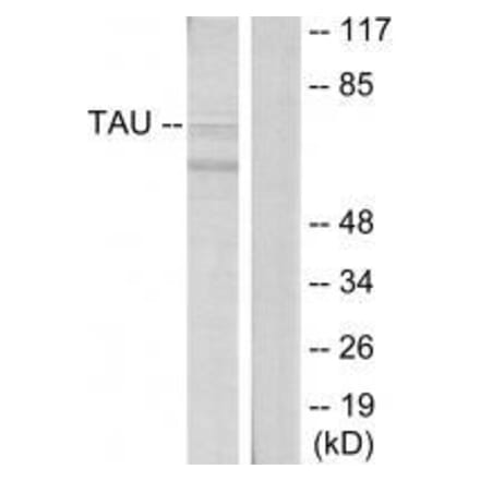 Western blot - Tau (Ab-396) Antibody from Signalway Antibody (33207) - Antibodies.com
