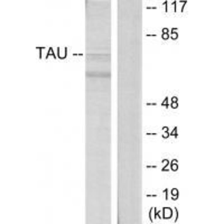 Western blot - Tau (Ab-396) Antibody from Signalway Antibody (33207) - Antibodies.com