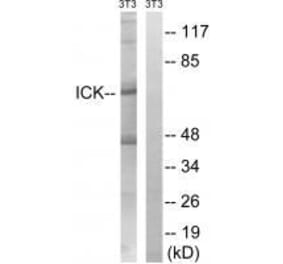 Western blot - ICK (Ab-159) Antibody from Signalway Antibody (33228) - Antibodies.com