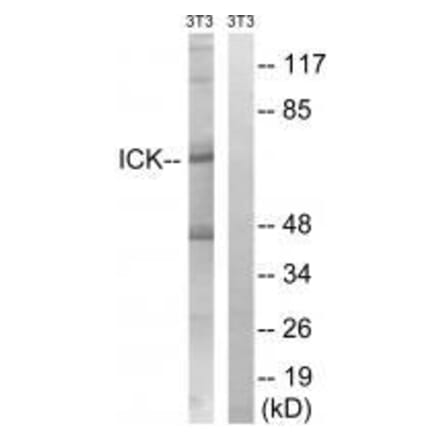 Western blot - ICK (Ab-159) Antibody from Signalway Antibody (33228) - Antibodies.com