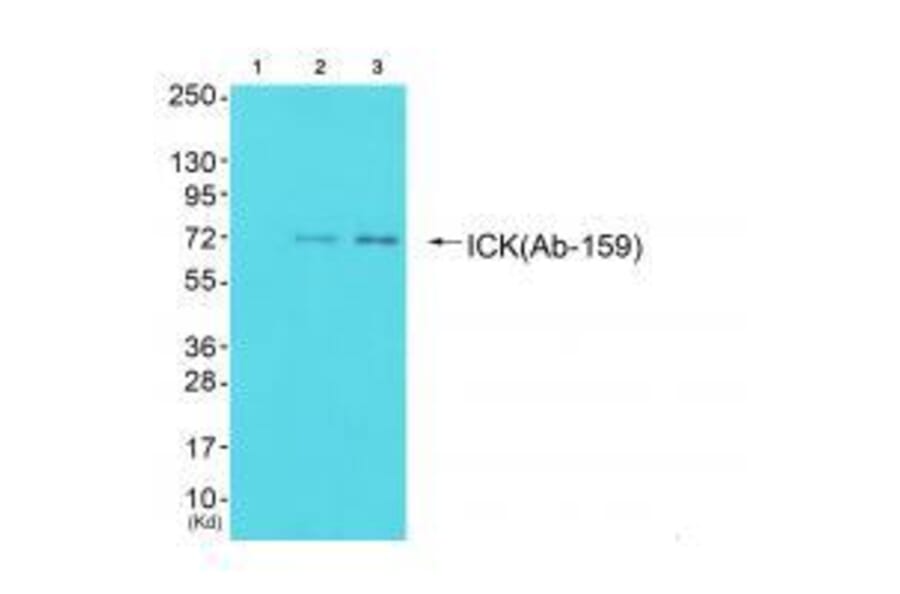 Western blot - ICK (Ab-159) Antibody from Signalway Antibody (33228) - Antibodies.com